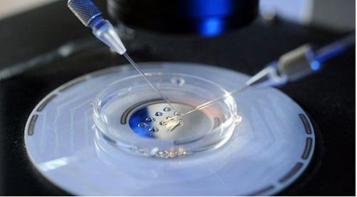 2022年北京借卵做试管婴儿技巧指数。艾滋病，洗精子并不那么简单