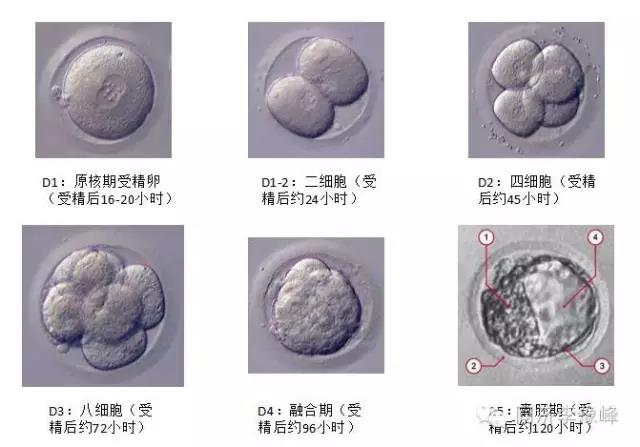 供卵试管婴儿用新鲜胚胎还是囊胚好？