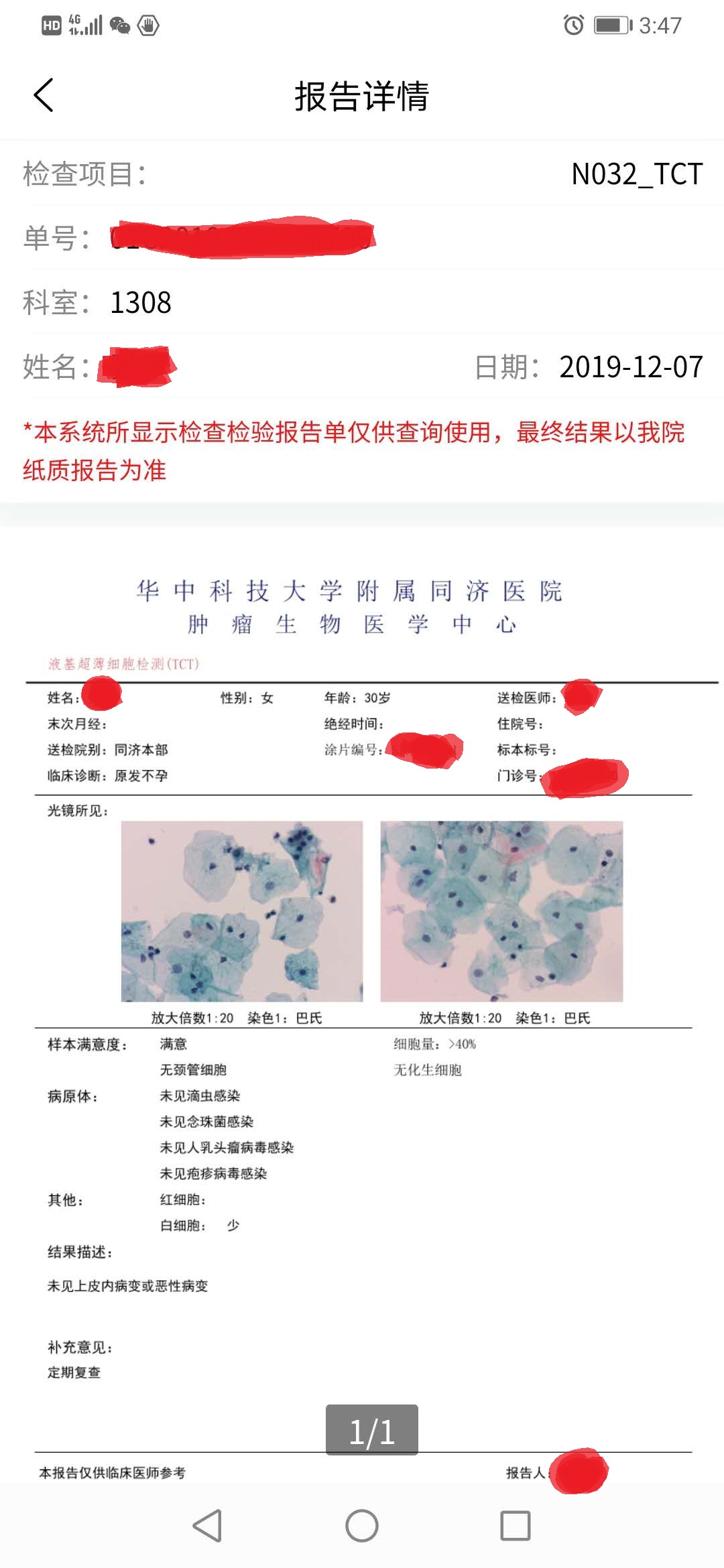 什么是赠卵试管婴儿过程？关于赠卵试管婴儿你需要知道什么