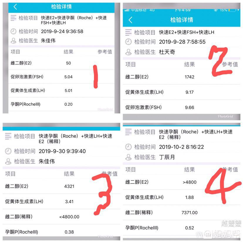 郑州不孕供卵代生自卵自怀，不育做借卵试管供精代怀医院哪家好？