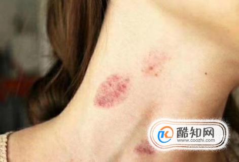 兰州能做三代赠卵试管选龙凤胎吗附详细医院排名