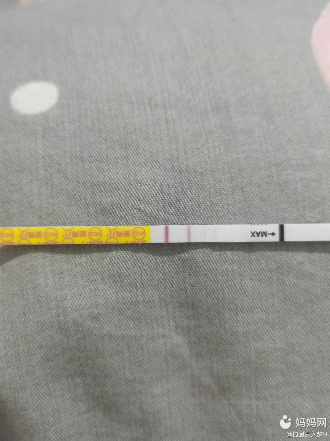 做借卵试管为啥要做宫腔镜