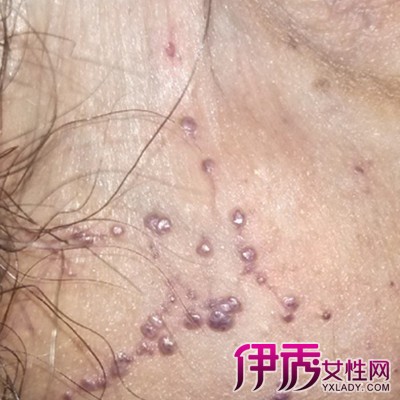 北京鼓楼医院做供卵赠卵试管要排队吗申请供卵需要满足什么条件