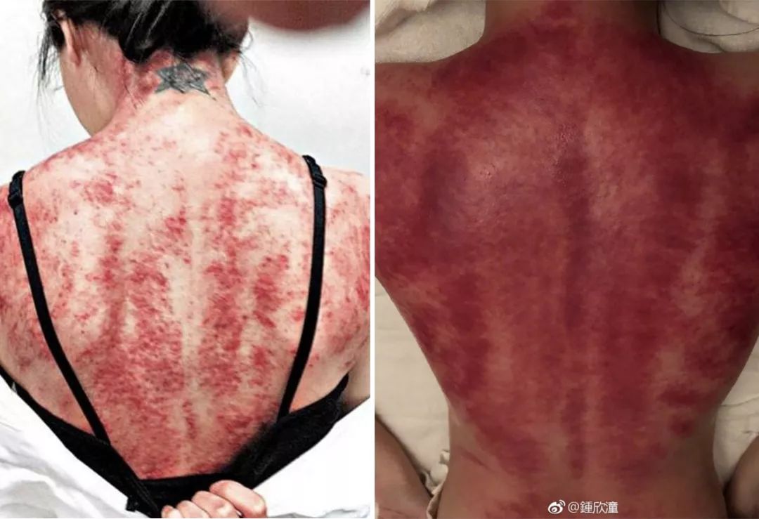 设什借卵做试管婴儿