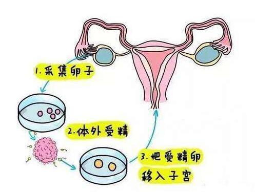 北京私立试管婴儿医院