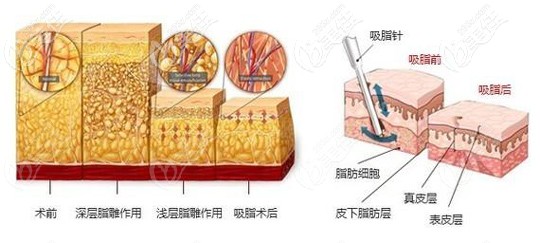 北京做试管移植第27天出血,常见6大原因都在这里