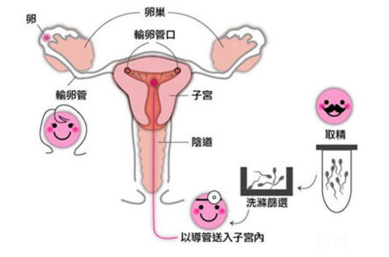 女性卵巢早衰会出现什么症状怎么治疗