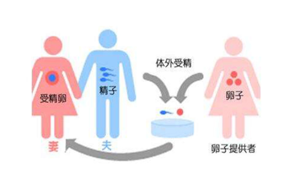 试管包干是什么意思
