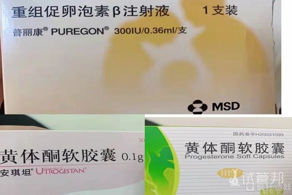 试管移植龙凤胎和双胞胎的几率