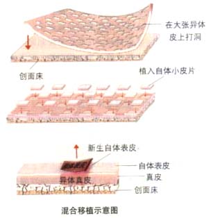 做试管婴儿长方案需要多长时间