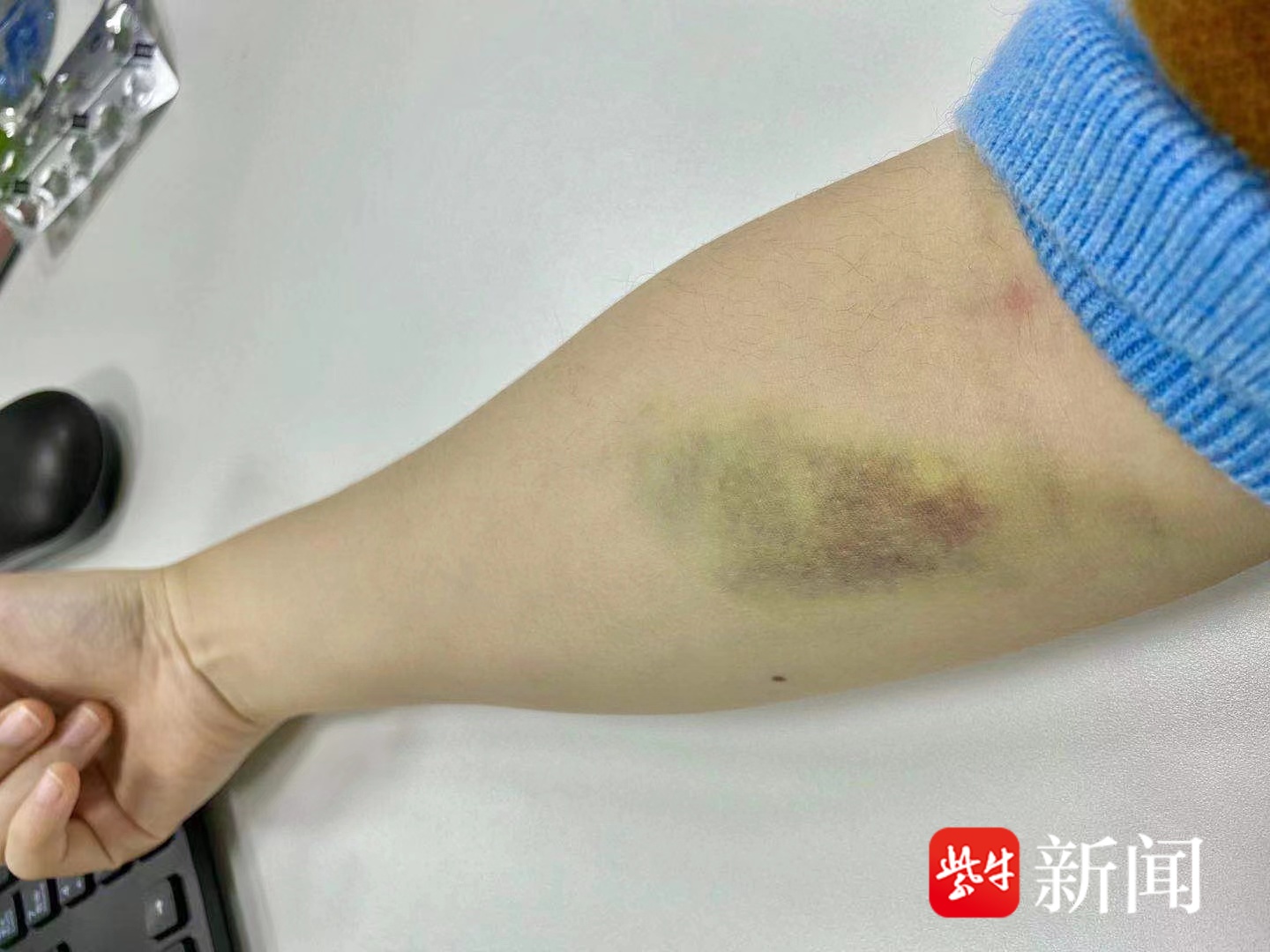 做试管双胞胎需多少钱试管一个好还是两个好