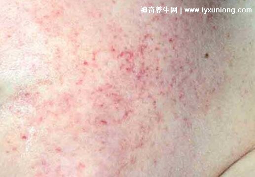 输卵管动不动就堵,到底是什么原因造成的呢？