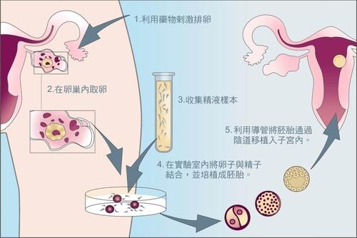 先天性子宫纵隔对北京代生孩子医院多少钱有多大影响