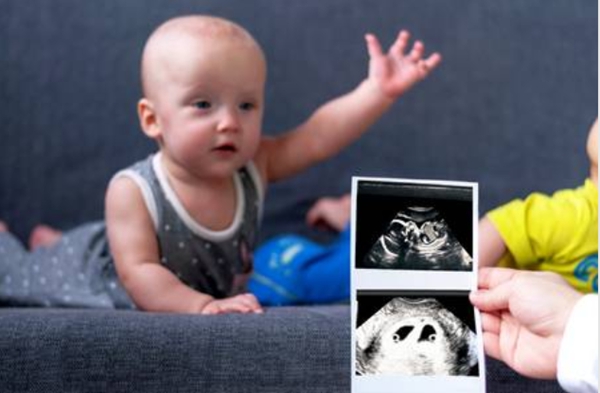 代怀生子私立医院并发症—卵巢过度刺激综合征(OHSS)