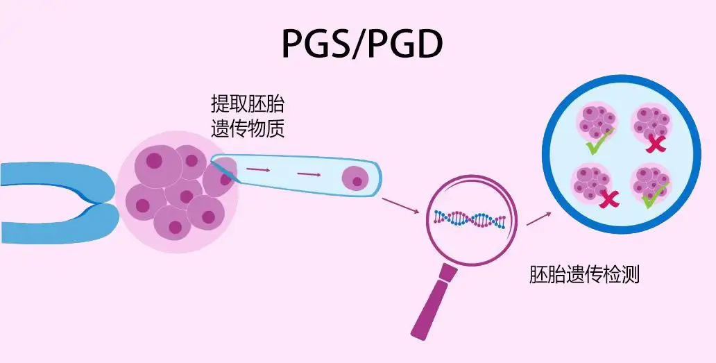 有卵巢巧克力囊肿能国内试管代怀哪家好婴儿吗（解读卵巢巧克力囊肿自供卵精代怀婴儿成功率是不是很低）