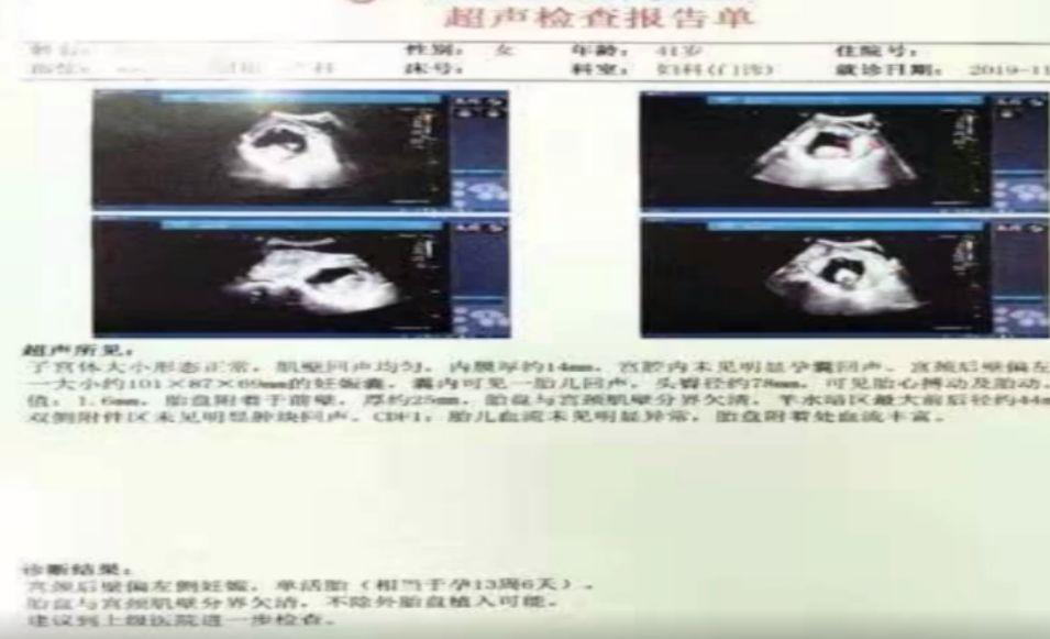 精子腥味重是什么原因