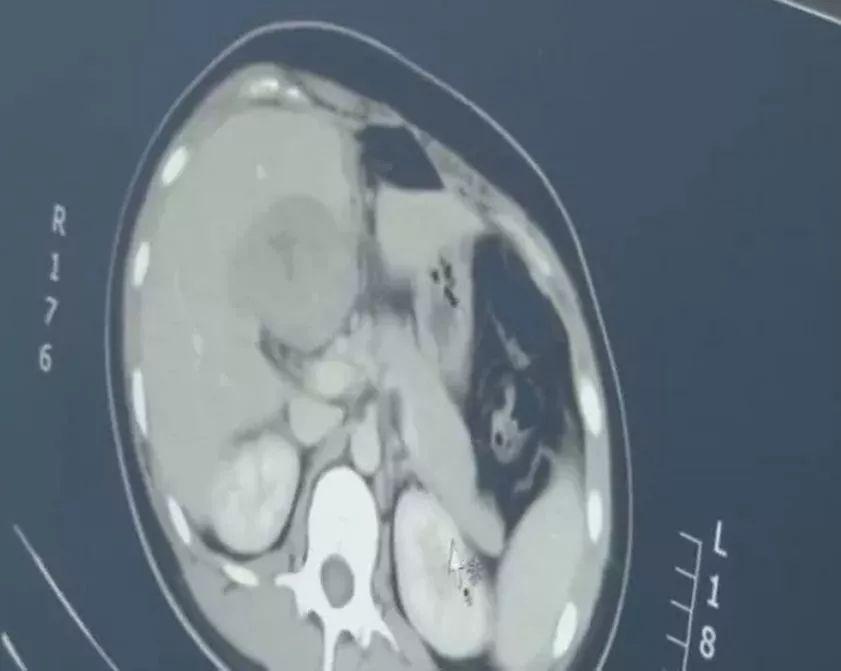 第二代试管代怀是怎么样的全过程要多久_做一个北京试管代怀可以顺产吗要多少钱